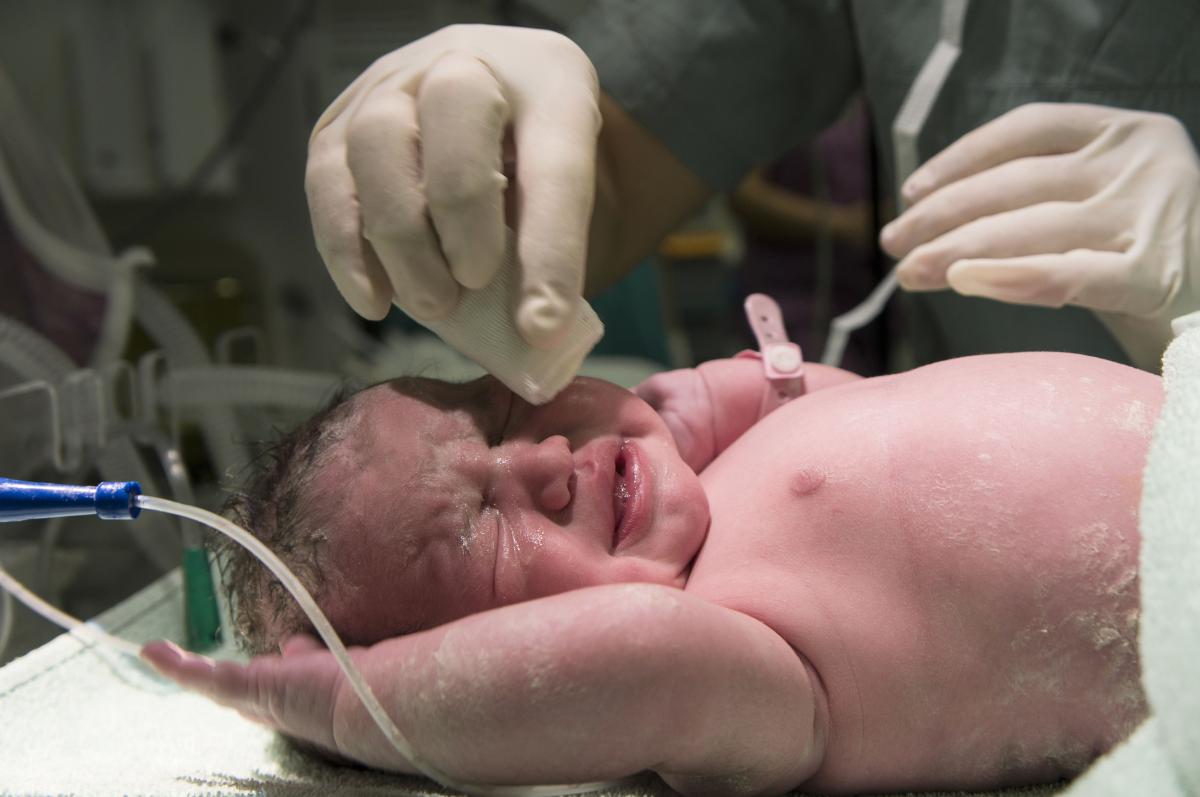 Qué pasa si mi bebé tiene placenta en la cara