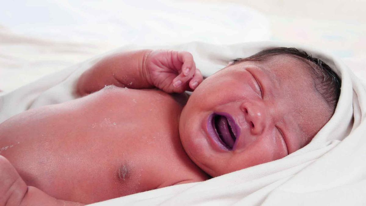 Cianosis en bebés: síntomas, causas y consecuencias