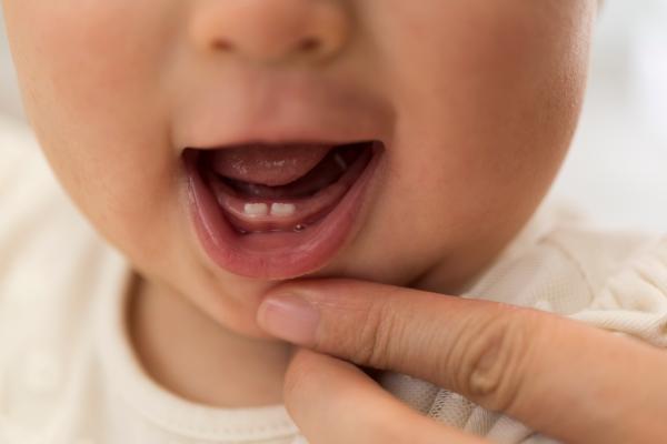 Por qué hay bebés que nacen con dientes: significado, porcentaje y riesgos - ¿Qué pasa si mi bebé recién nacido nace con dientes?