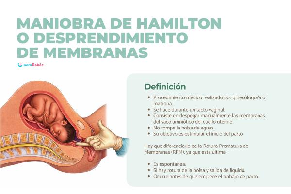Desprendimiento de membranas en el embarazo: qué es y síntomas