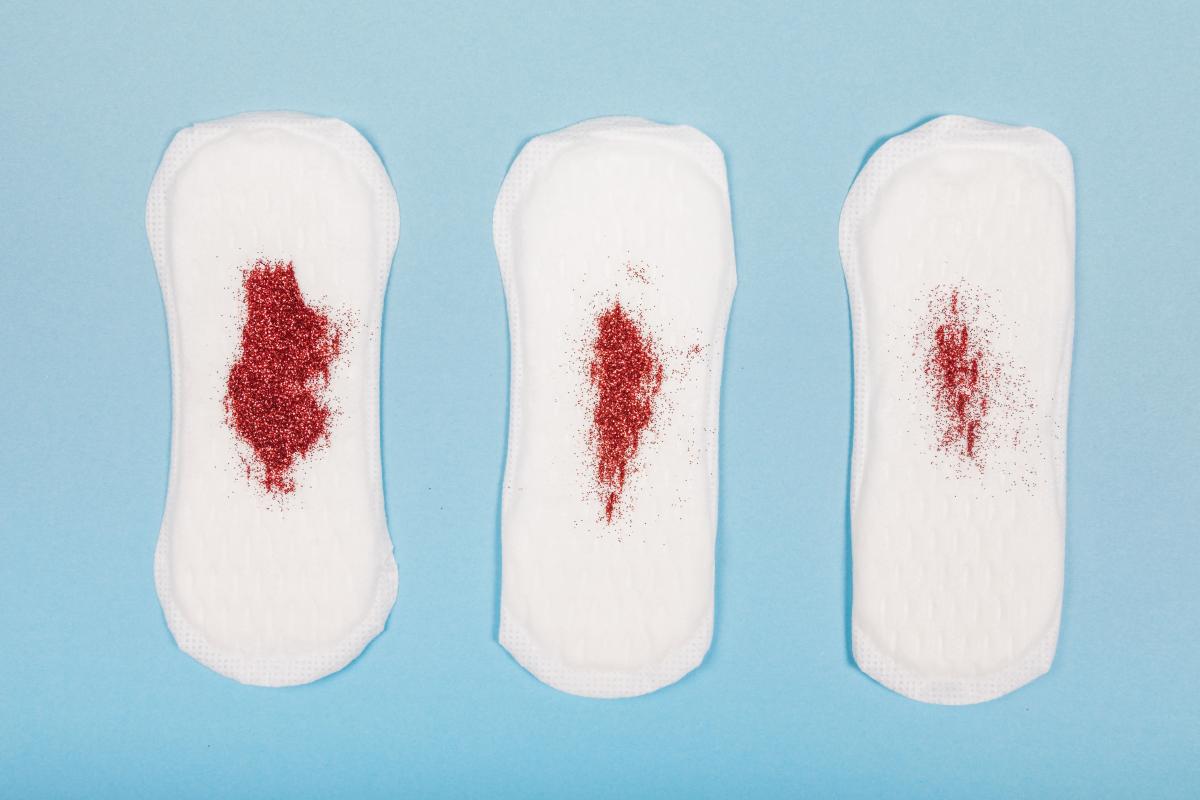 ¿El sangrado de implantación duele como la regla?