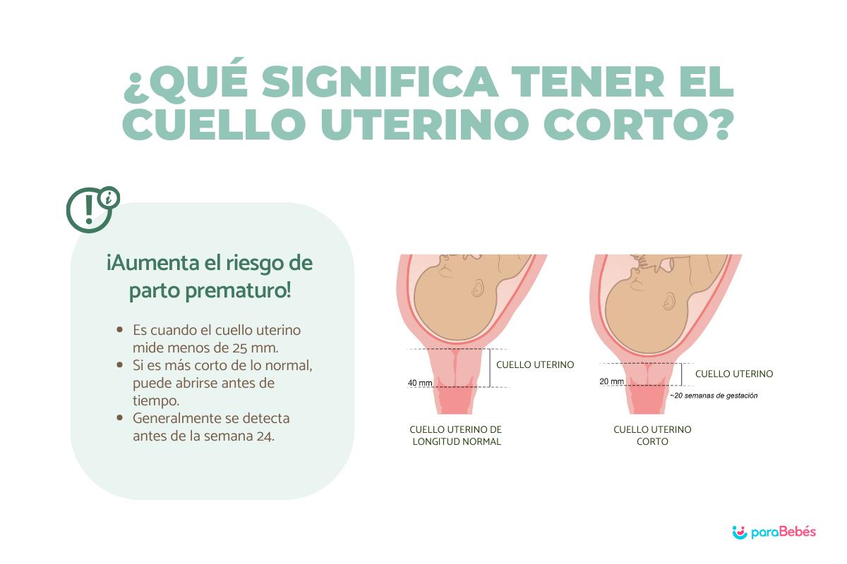 Cuello uterino corto en el embarazo o insuficiencia: causas y tratamiento