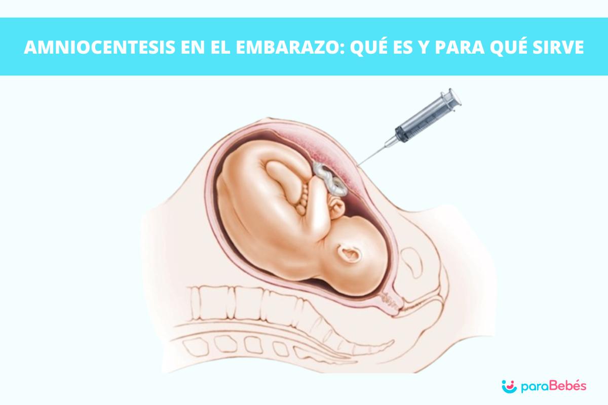 Amniocentesis en el embarazo: qué es, riesgos y cuándo realizarla
