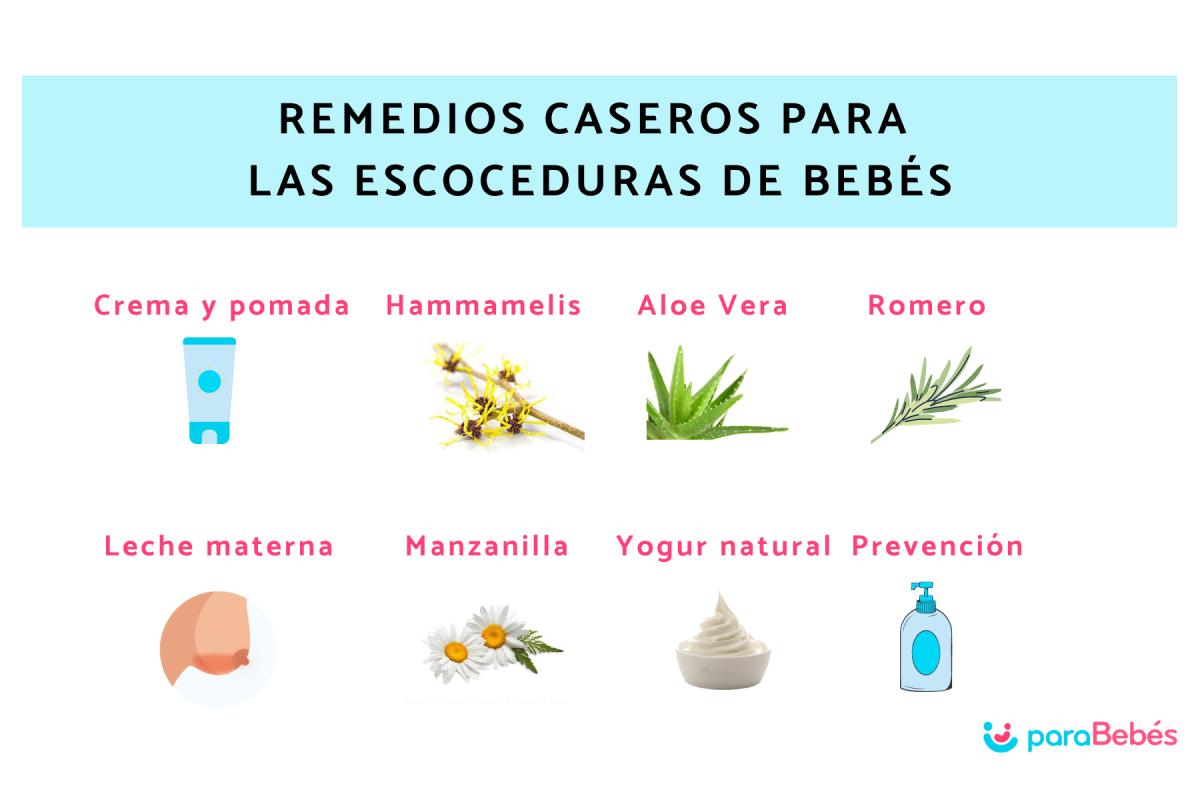 Remedios caseros para las escoceduras de bebés