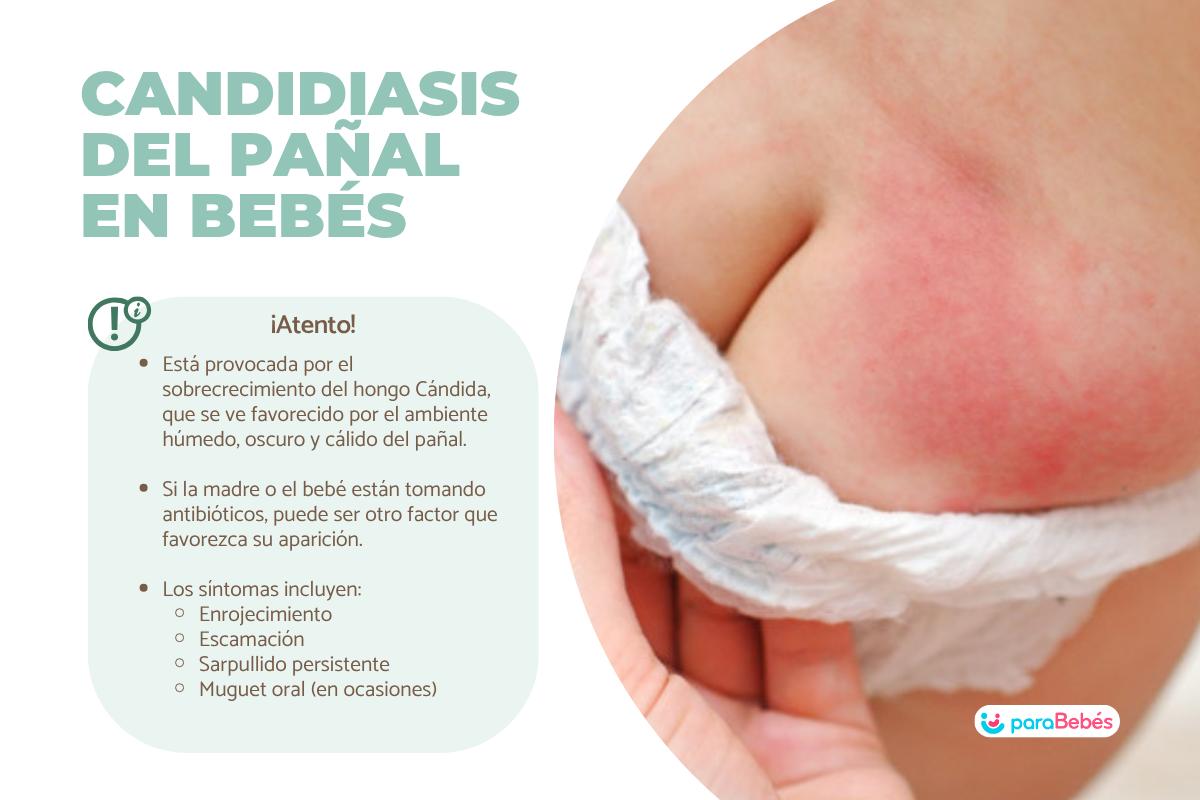Candidiasis en bebés por pañal: contagio y tratamiento