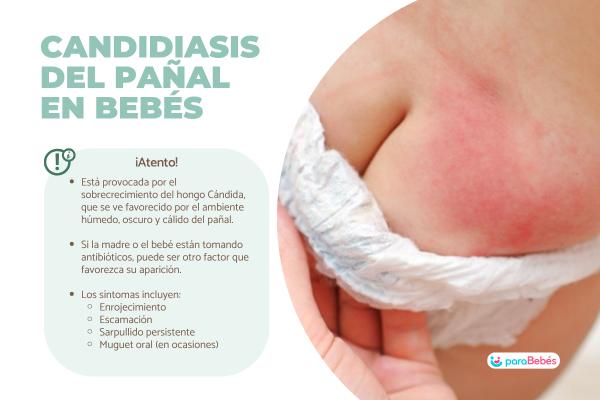 Candidiasis en bebés por pañal: contagio y tratamiento