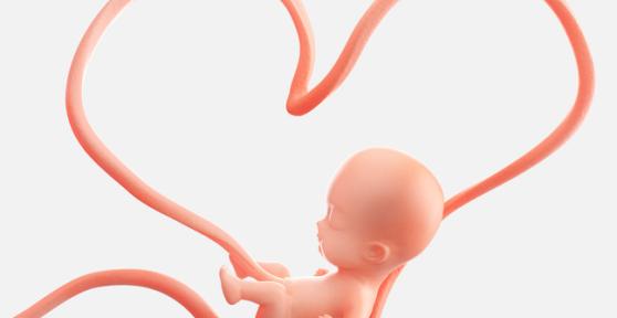 Mi bebé está enredado con el cordón umbilical, ¿es peligroso?