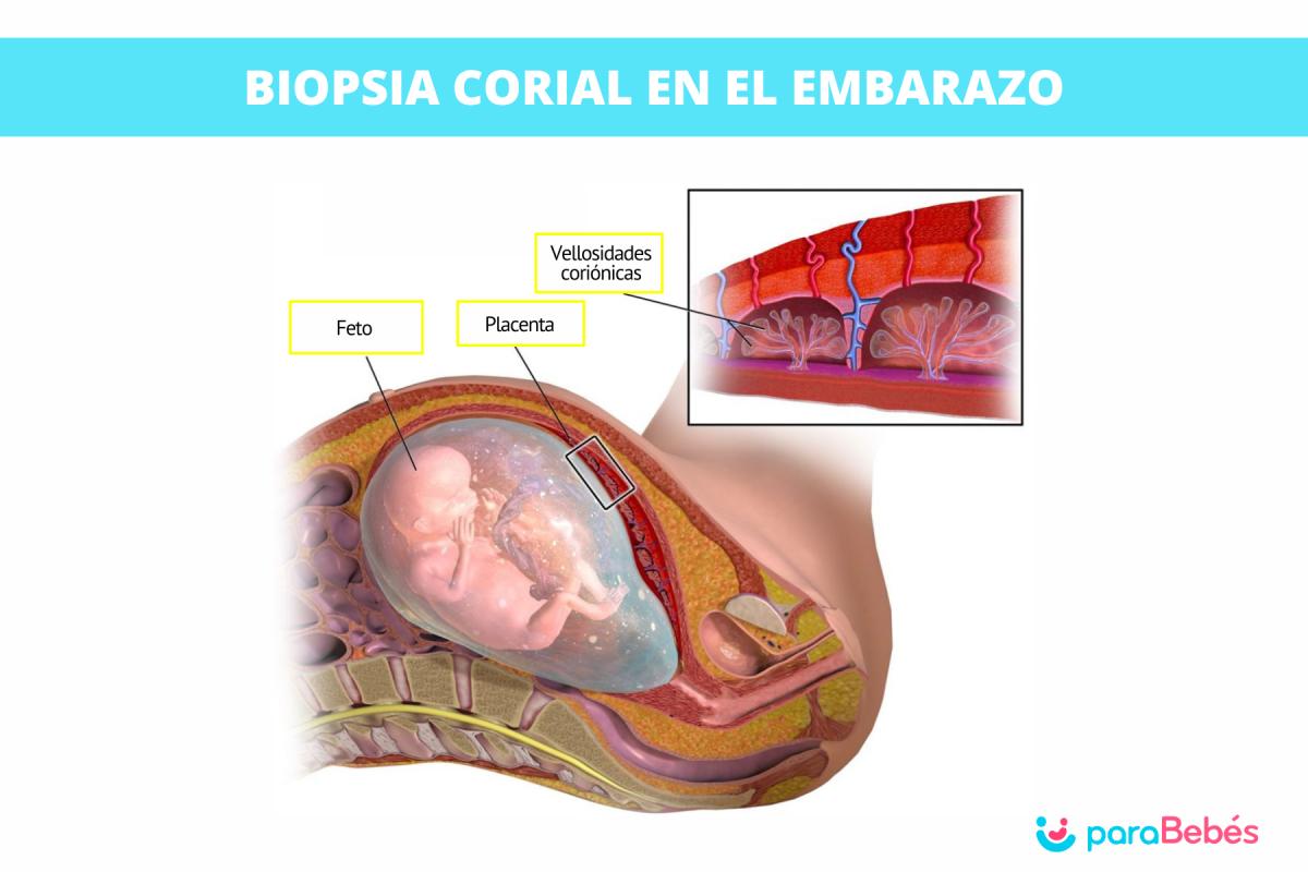 Biopsia corial en el embarazo: qué es, enfermedades que detecta y fiabilidad