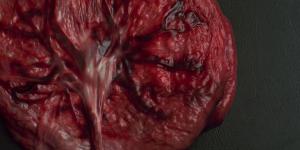 ¿Se puede comer la placenta después del parto?