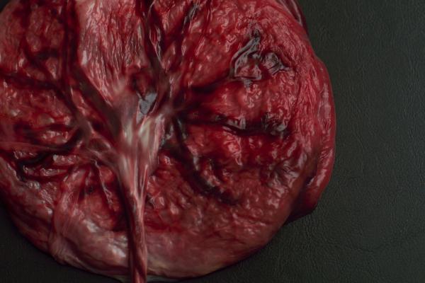 ¿Se puede comer la placenta después del parto?