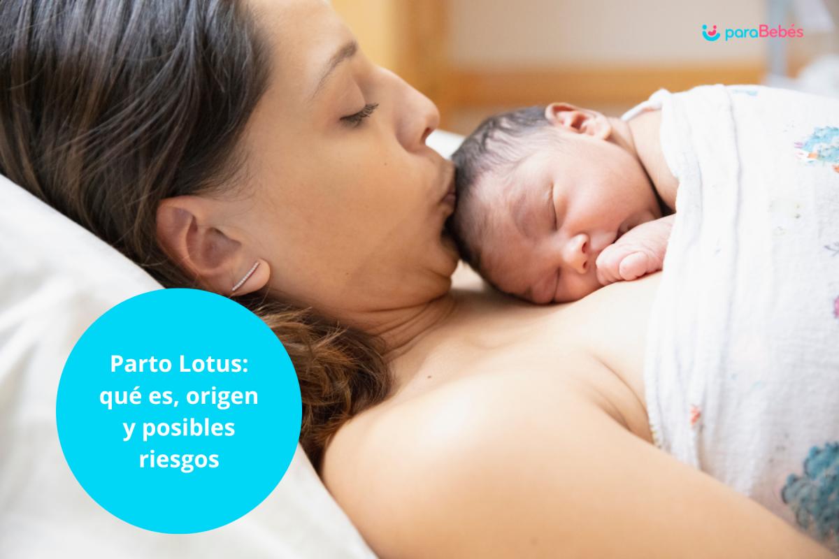 Parto Lotus: qué es, origen y posibles riesgos