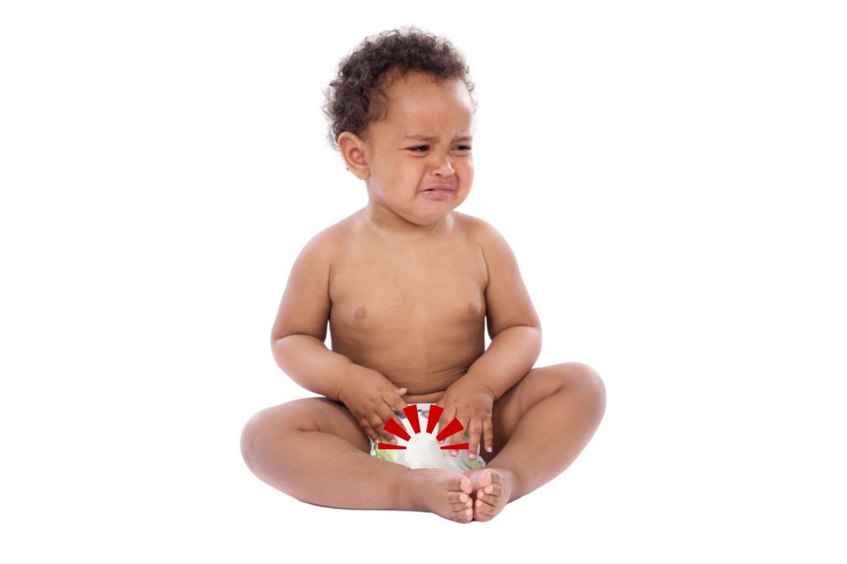 Balanitis en bebés: qué es, causas, síntomas y tratamiento