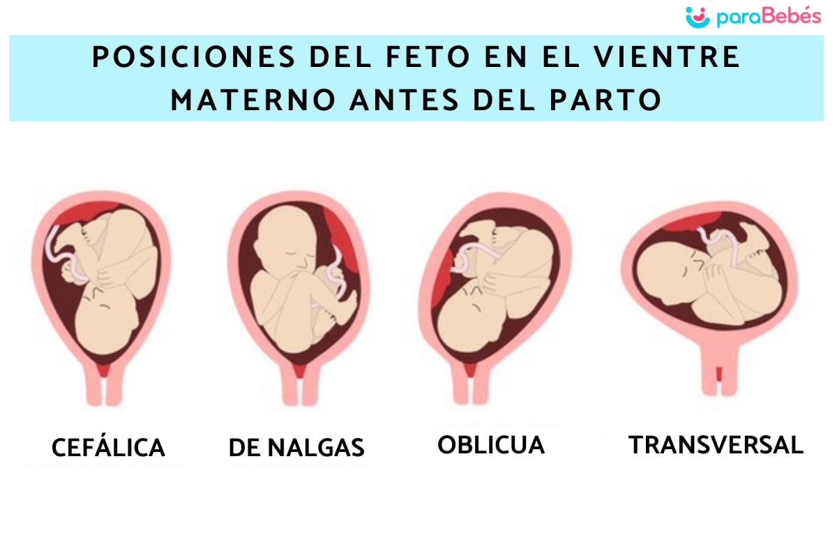 Las posiciones del feto en el vientre materno antes del parto