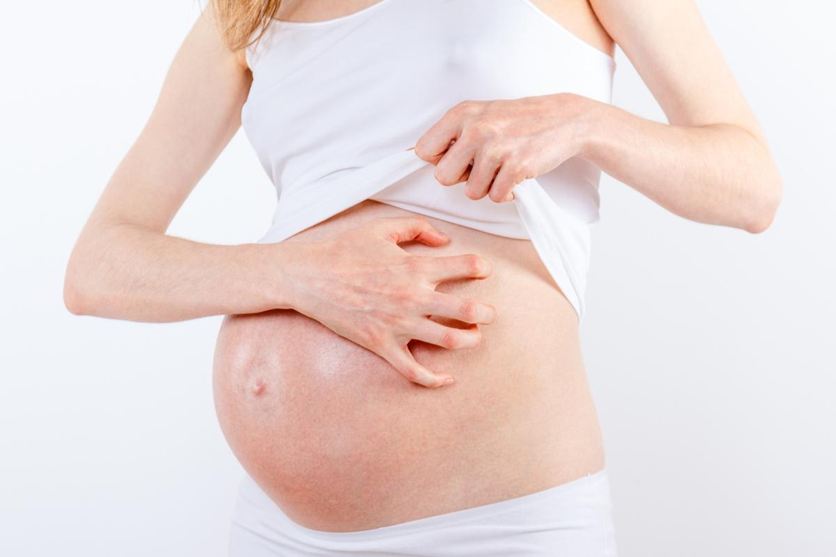 Colestasis intrahepática del embarazo: tratamiento, síntomas y diagnóstico