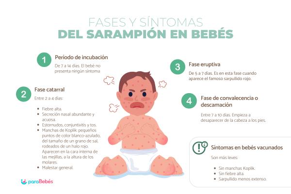 Sarampión en bebés: síntomas y tratamiento - ¿Cuáles son los síntomas de sarampión en bebés?