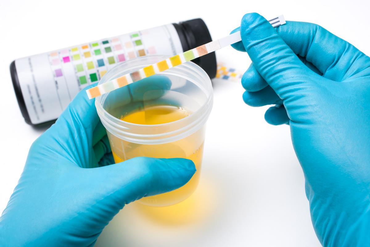 Por qué hay proteínas en la orina en el embarazo